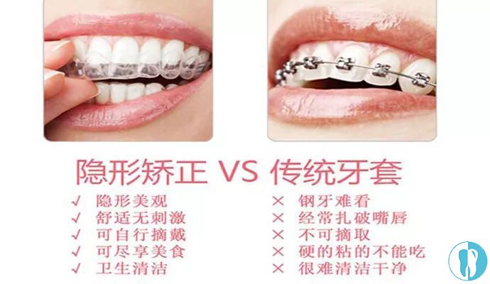 当真?上海隐形牙齿矫正14999元起,价值千元的口扫免费送