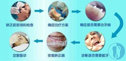 科普|牙齿矫正过程，你需要经历这11个阶段