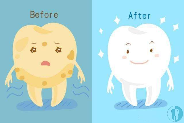 牙黄了如何让牙齿变白?快看都在用的冷光美白有木有副作用