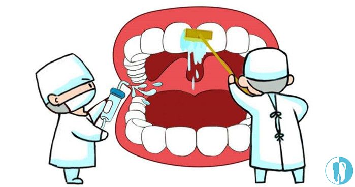 牙周炎的治疗方法