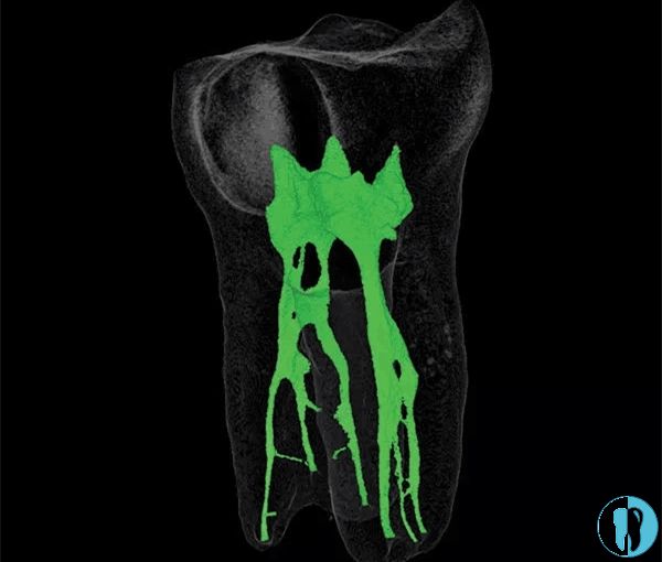 绿色部分就是牙神经