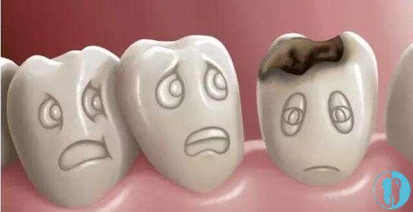 牙髓炎的病因就是龋病