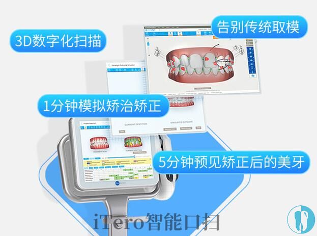 重庆美奥口腔数字化牙齿矫正口扫设备