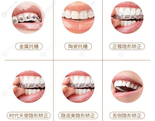 上海尤旦口腔牙齿矫正.jpg