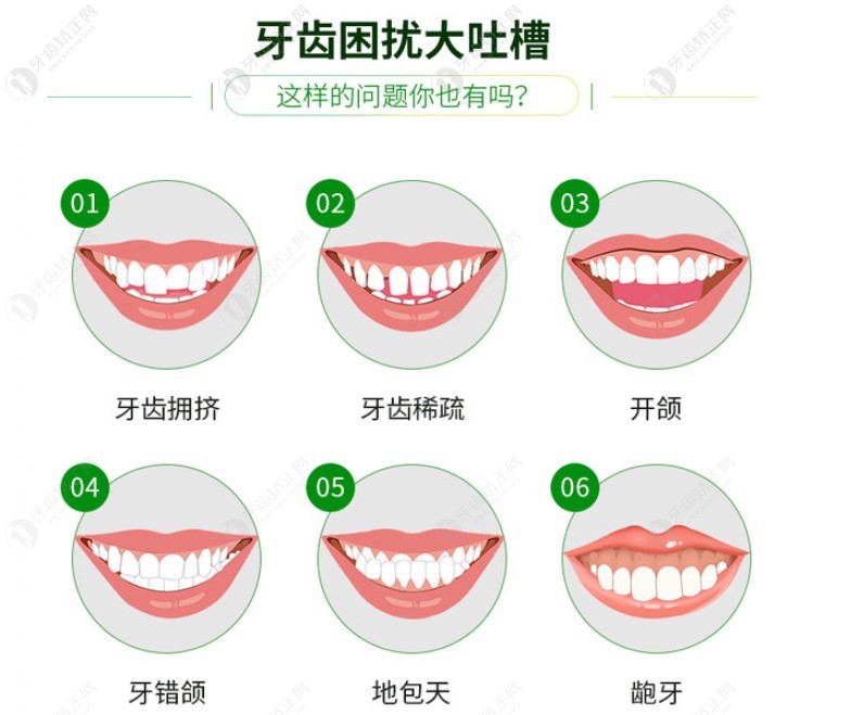 哪些牙齿畸形需要矫正