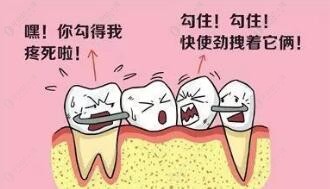 活动假牙的缺点