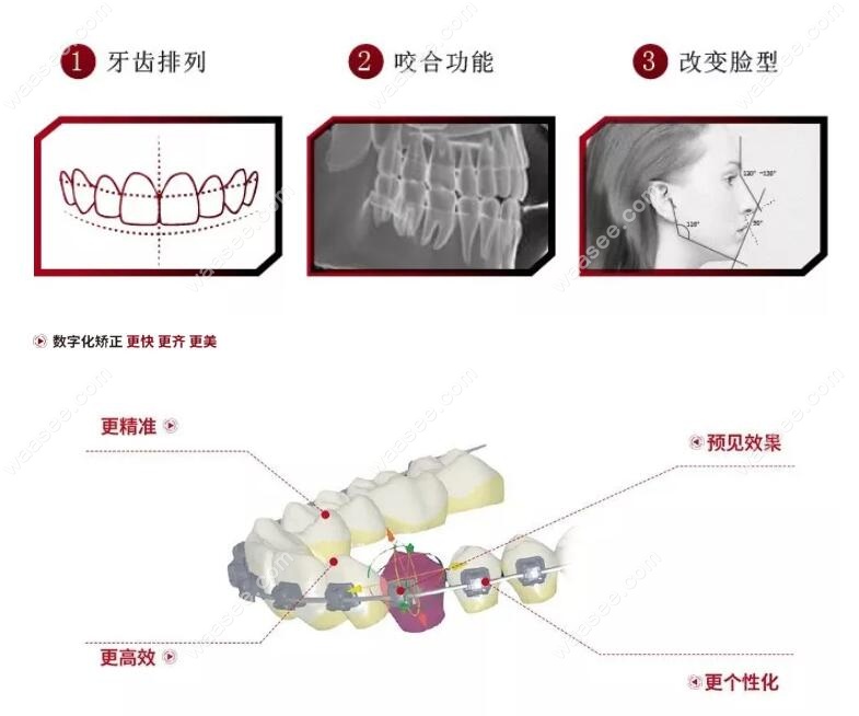 牙博士美学矫正