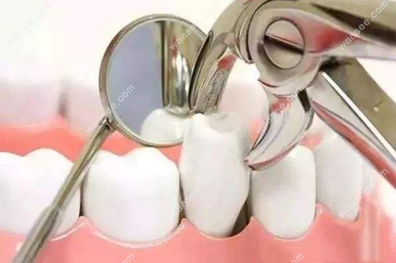 杨春犁医生科普为什么牙齿矫正需要拔牙