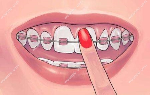 陈文昌医生建议大家尽量别错过牙齿矫正的三个较佳时间