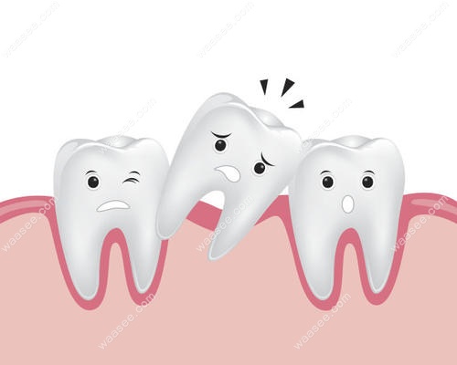 骨性二类导致的嘴凸只通过正畸效果好么？答案在这！