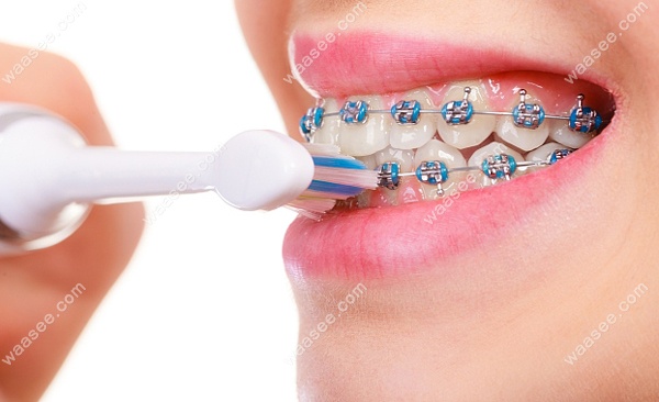 谢亚明医生谈影响牙齿矫正价格的因素