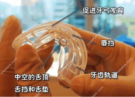 肌功能矫正器