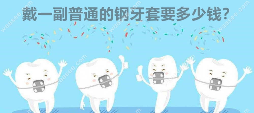 钢牙套的价格