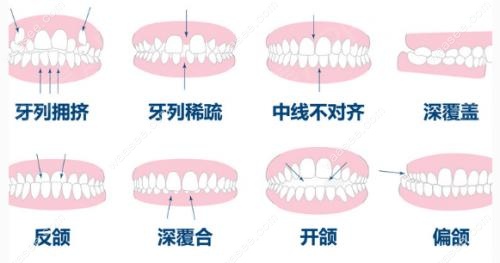 牙齿的各种症状