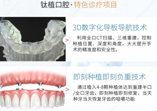 北京钛植口腔的种植牙特色
