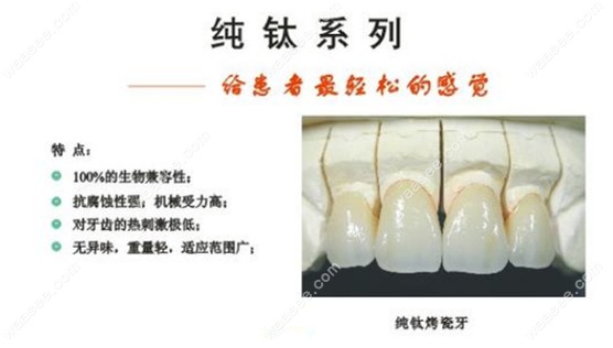 纯钛假牙