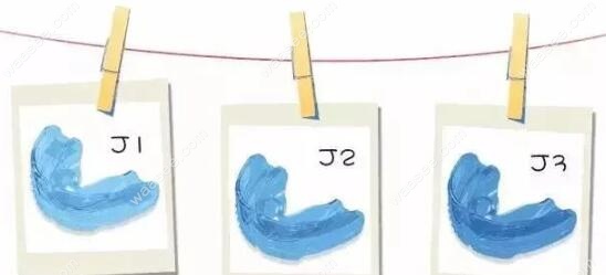 mrc矫正器j系列