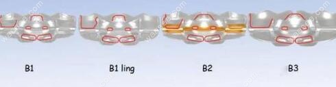 mrc矫正器b系列