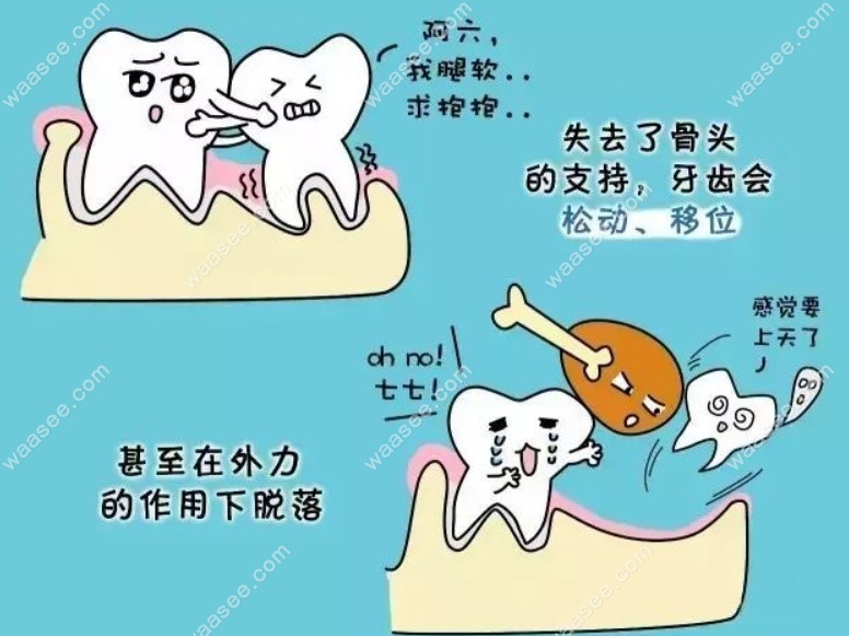 23岁牙齿松动是什么原因