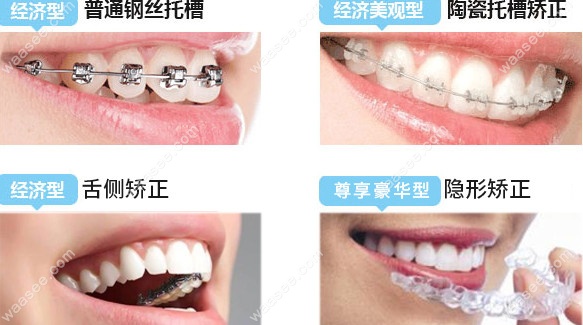 正畸