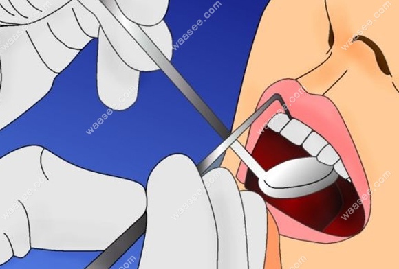 在重庆沙坪坝区这家众植博仕牙科做的牙齿矫正