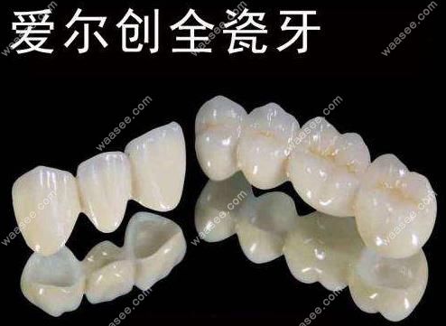 爱尔创全瓷牙