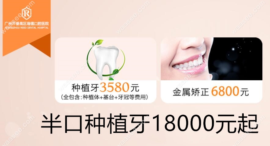广州番禺区牙科医院好又便宜的是这家,半口种植牙收费1w多