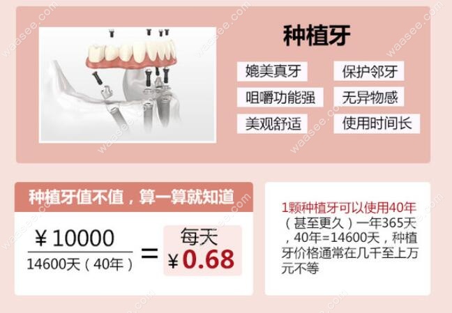 种植牙价格虽然贵但是长期来看很划算