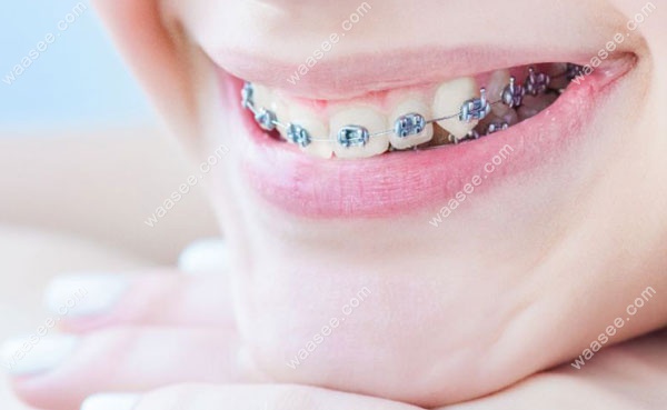 牙齿代偿性正畸和掩饰性正畸是什么意思,区别大吗？
