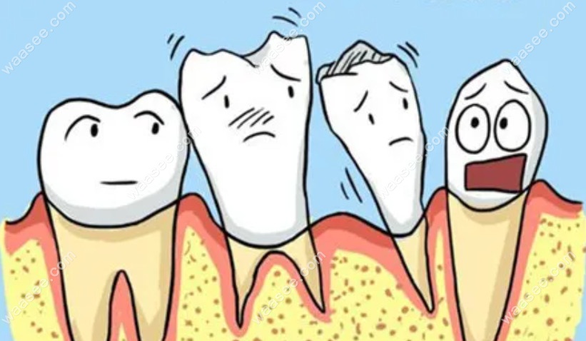 牙龈退化萎缩是什么原因引起的