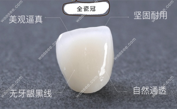 国产二氧化锆全瓷牙冠