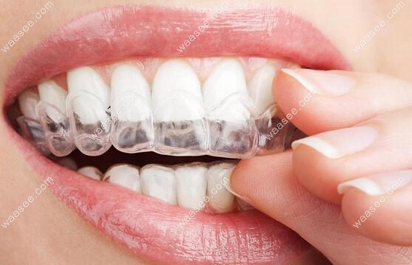 有牙医表示做过全瓷贴面后不建议做正畸