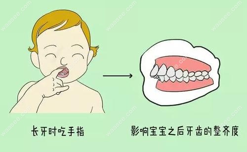 长牙时吃手指会导致龅牙