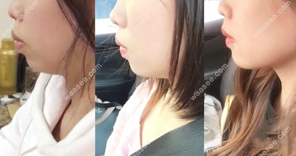 合肥美奥口腔矫正牙齿好不好