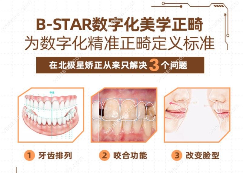 北极星口腔数字化美学正畸标准
