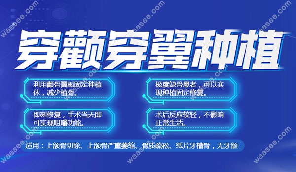 南京博韵口腔医院已完成多例穿颧骨种植牙