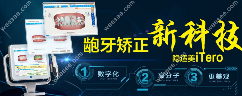 龅牙矫正的优势