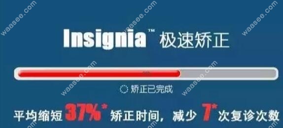 Insignia精准正畸的优点