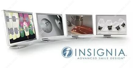 Insignia精准正畸数字化正畸