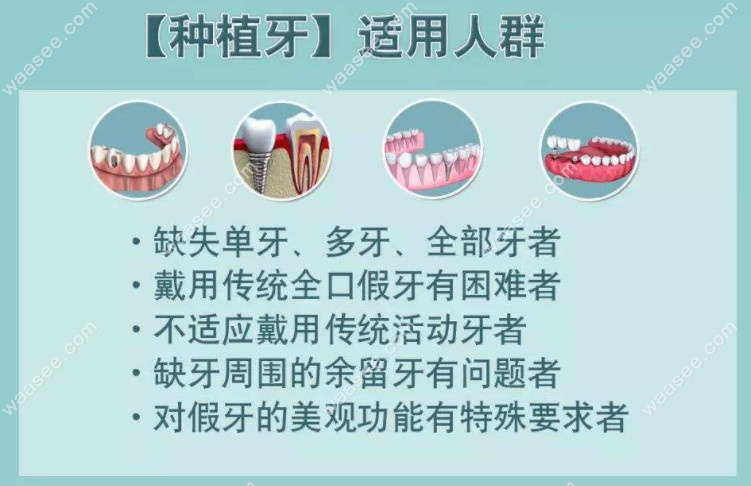 什么是无种植仿生牙?其与种植牙的区别有什么不同