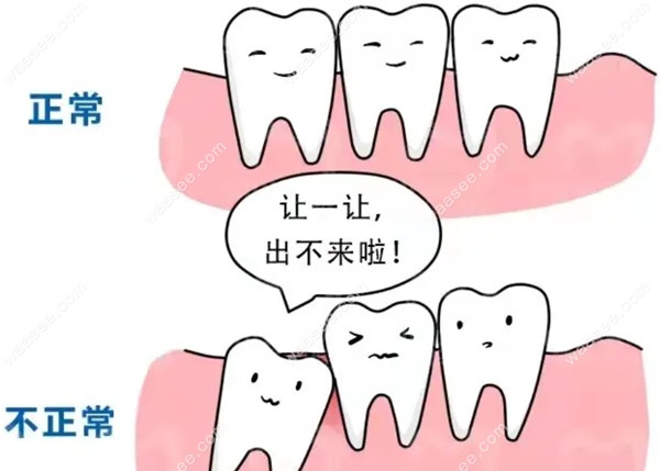 超出牙齿正常数量的多生牙