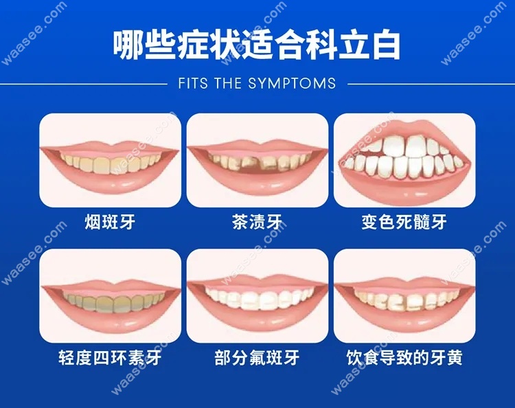 美国科立白牙齿美白适应症