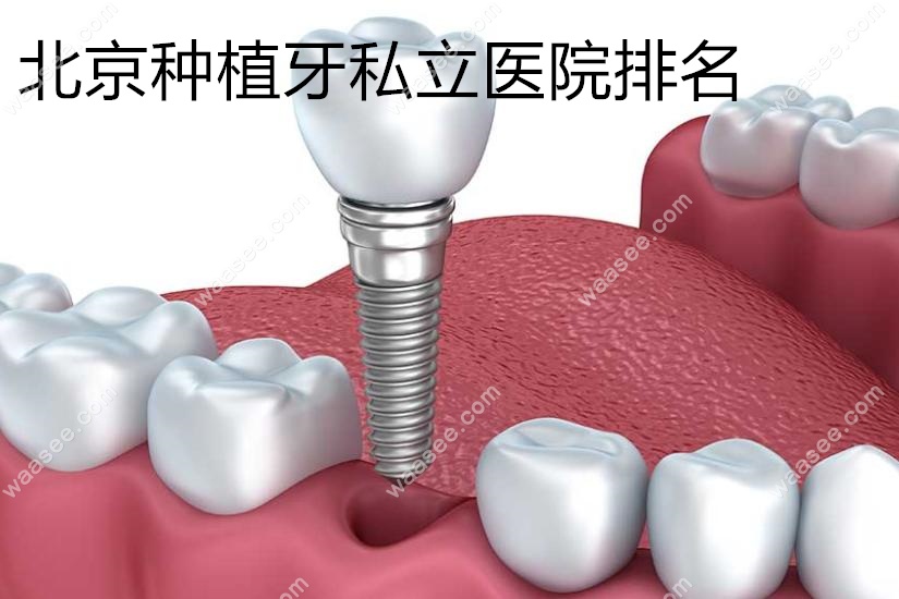 新版北京种植牙私立医院排名,哪里种牙便宜技术好显而易见