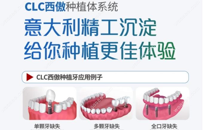 西傲clc种植系统