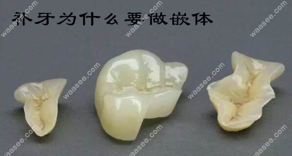 为什么补牙要做嵌体修复