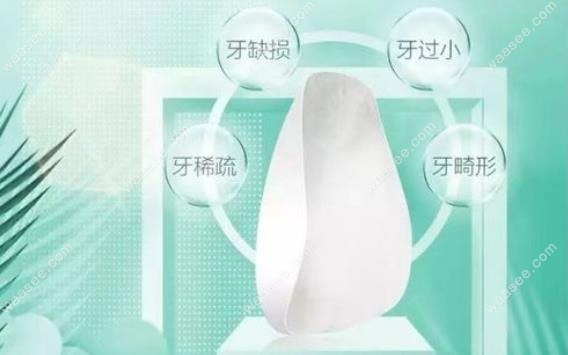 义获嘉瓷贴面优势点