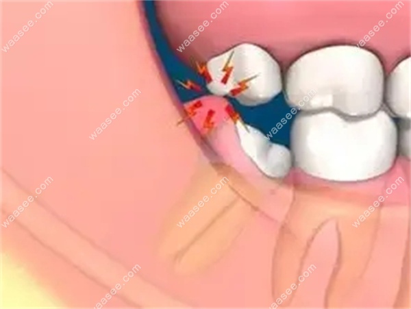 src=http___5b0988e595225.cdn.sohucs.com_images_20200408_3d34b6789cf94983aed090aa692d42ee.jpeg&refer=http___5b0988e595225.cdn.sohucs.webp.jpg