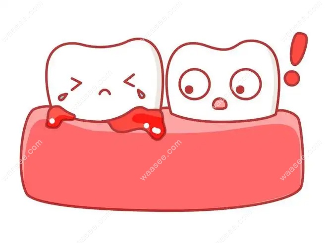 牙周炎导致的牙龈萎缩还能恢复吗？预防牙龈萎缩注意四点