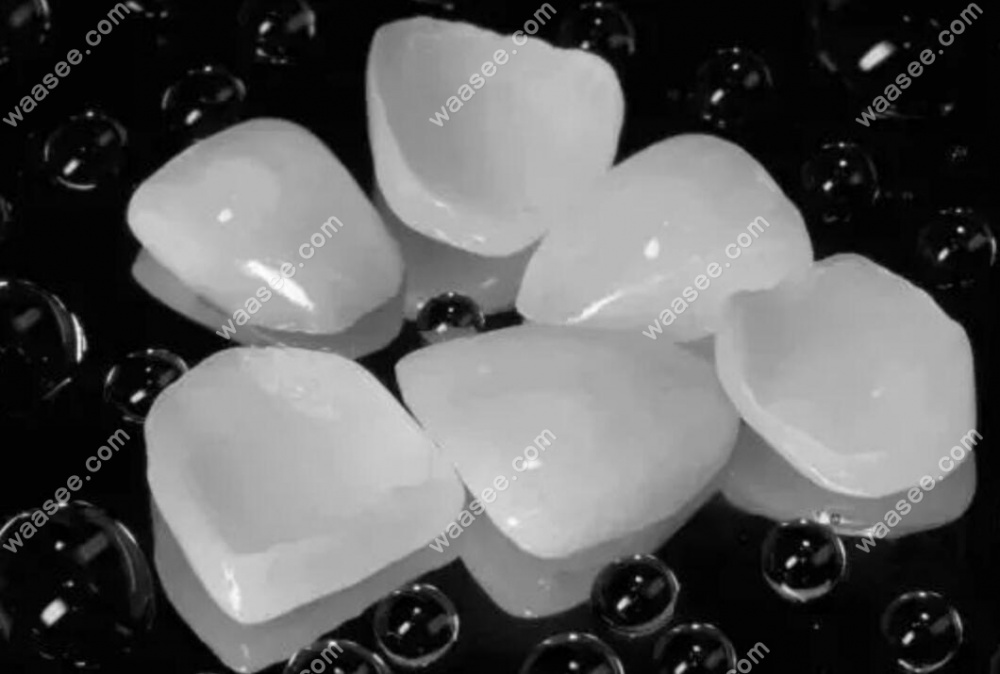 牙齿贴面能维持多久?牙齿瓷贴面使用寿命10年/20年/30年