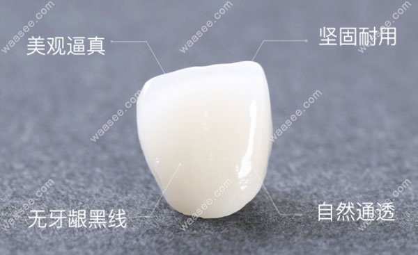 二氧化锆全瓷冠